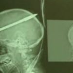 ΣΠΑΝΙΑ ΕΠΕΜΒΑΣΗ ΕΛΛΗΝΑ ΓΙΑΤΡΟΥ ΣΤΟ ΒΙΒΛΙΟ ΓΚΙΝΕΣ