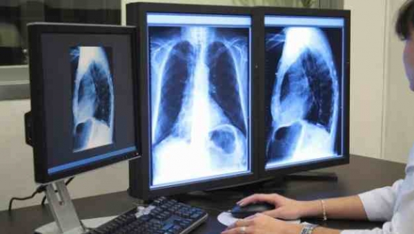 ΧΩΡΙΣ ΔΩΡΕΑΝ ΔΙΑΓΝΩΣΤΙΚΕΣ ΕΞΕΤΑΣΕΙΣ ΣΤΟΝ ΕΟΠΠΥ! – ΞΕΚΙΝΑ Η ΕΠΙΣΧΕΣΗ – ΤΙ ΘΑ ΥΠΟΣΧΕΘΕΙ Ο ΑΔΩΝΙΣ