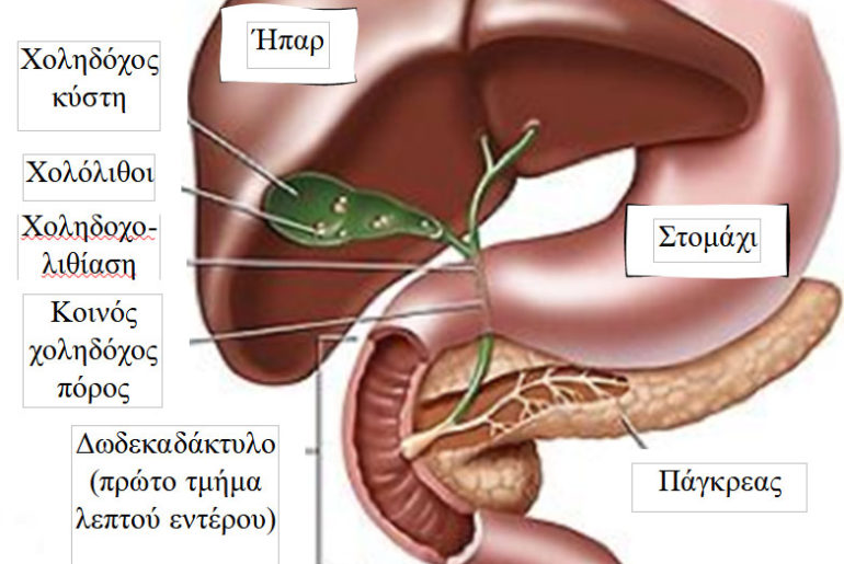 Όλα όσα πρέπει να γνωρίζετε για την Χολολιθίαση από τον Γιώργο Δελημπαλταδάκη