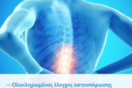 Ολοκληρωμένος έλεγχος οστεοπόρωσης σε προνομιακή τιμή από τον Όμιλο Affidea